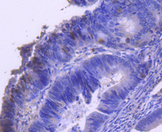 Phospho-Cyclin E1(T77) Rabbit mAb