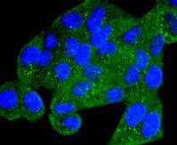 Phospho-AMPK alpha 1 (S496) Rabbit mAb