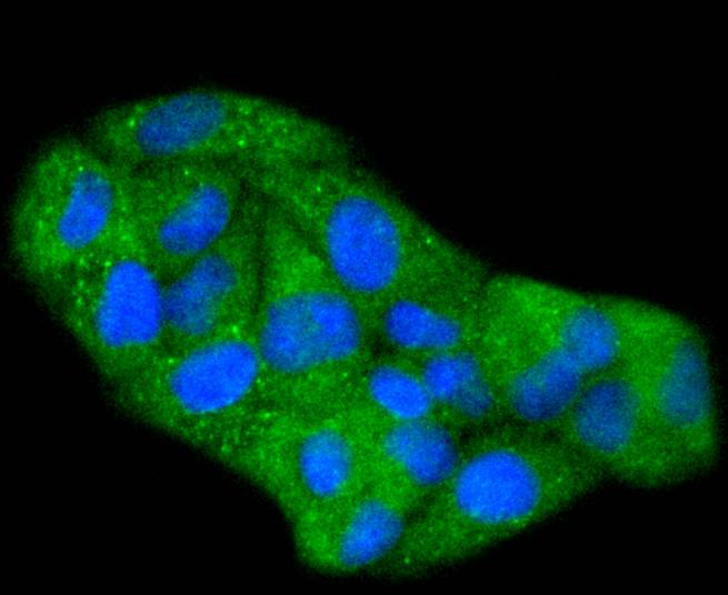 Phospho-Hsp27(S78) Rabbit mAb