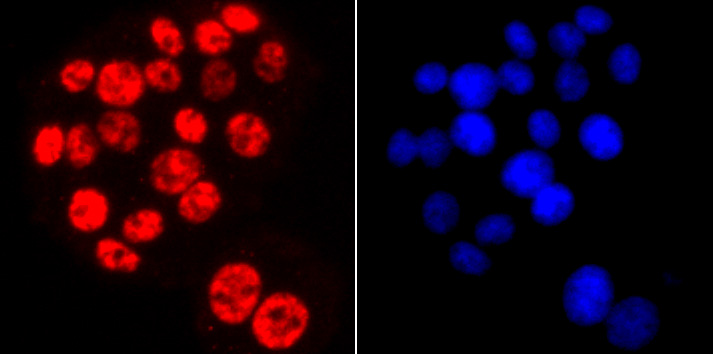 Phospho-POLR2A (S2) Rabbit mAb