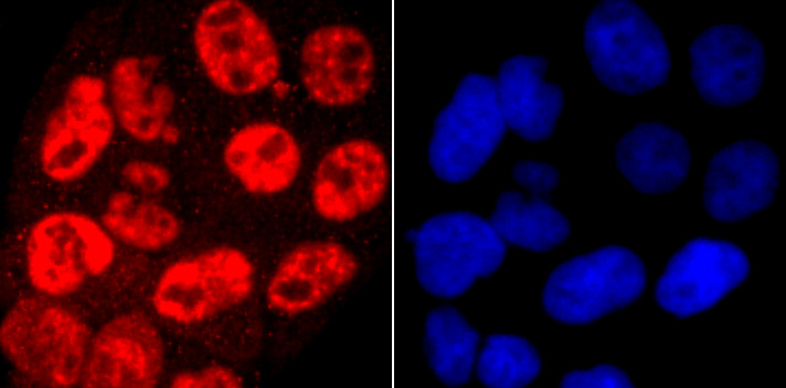 Phospho-POLR2A (S5) Rabbit mAb