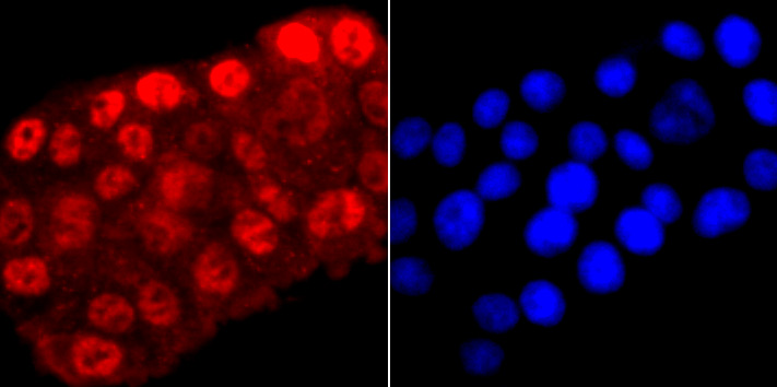 Phospho-POLR2A (S5) Rabbit mAb