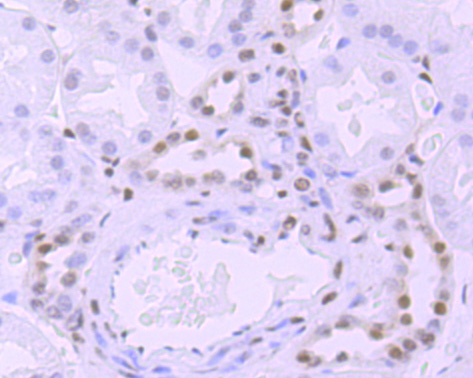 Phospho-POLR2A (S5) Rabbit mAb