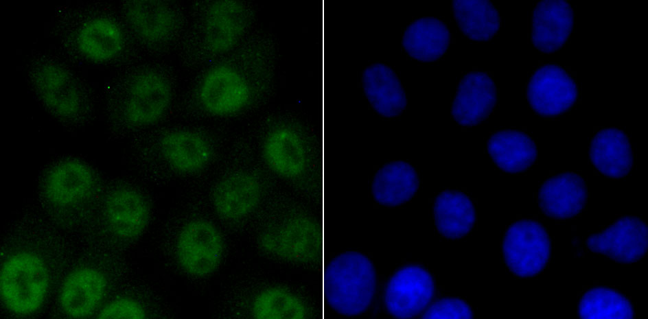 ATM (phospho S1981) Rabbit mAb