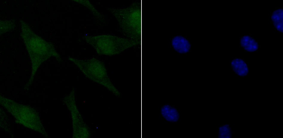ATM (phospho S1981) Rabbit mAb