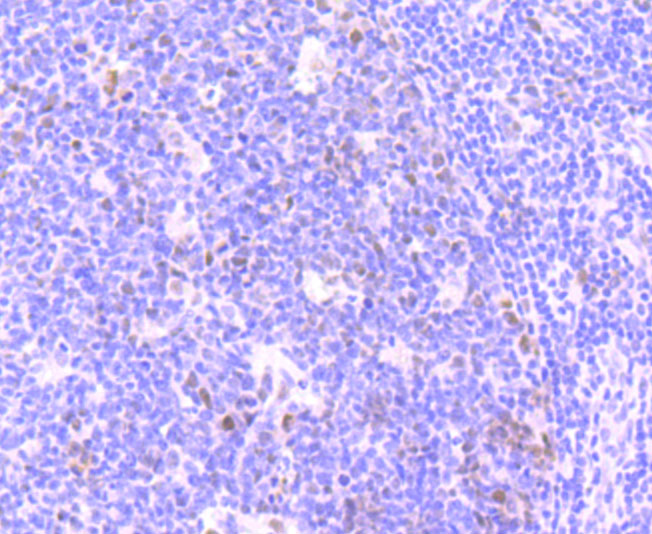 ATM (phospho S1981) Rabbit mAb
