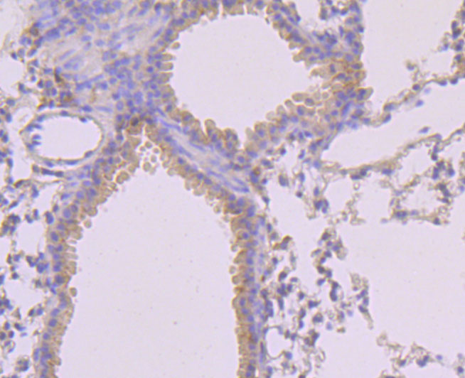 MLKL (phospho S345) Rabbit mAb