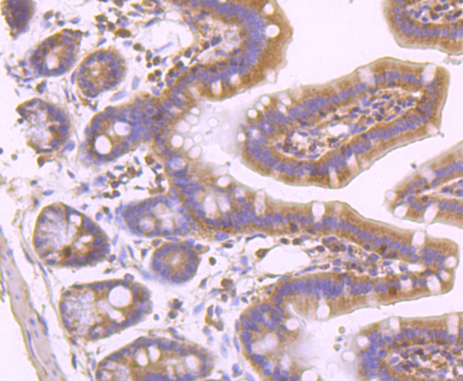 MLKL (phospho S345) Rabbit mAb