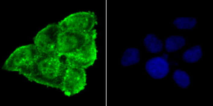 Phospho-alpha Synuclein (S129) Rabbit mAb