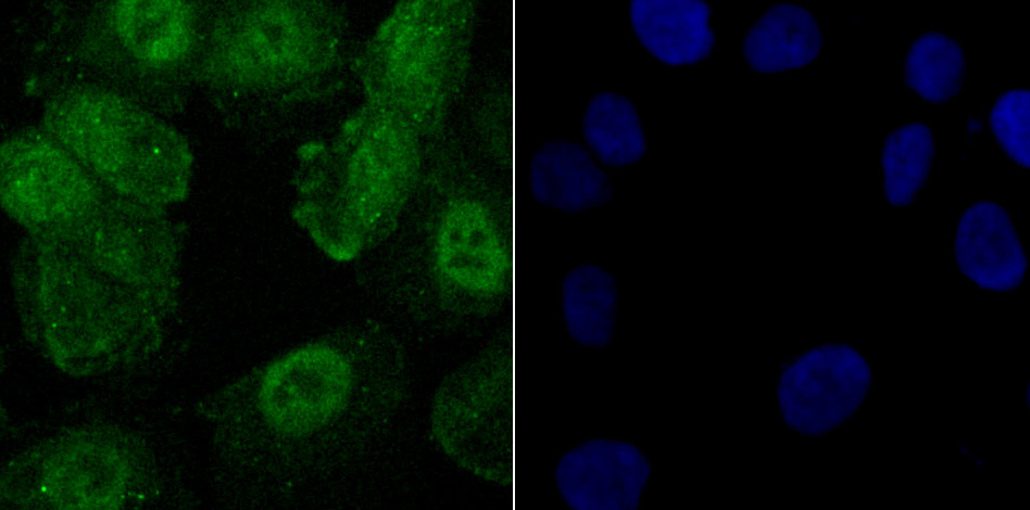 Phospho-Creb (S133) Rabbit mAb