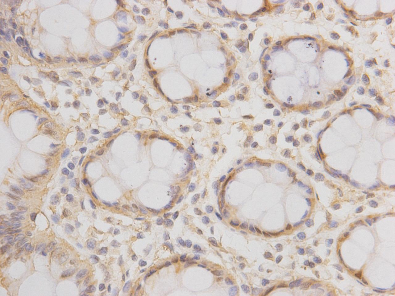 DNA-PKcs/PRKDC Antibody