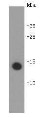 Interleukin 31 Antibody