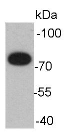 GRP78 BiP Antibody