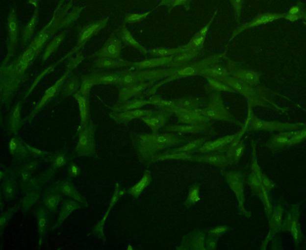 Glucose Transporter GLUT4 Antibody