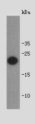 Shiga toxin subunit B Antibody