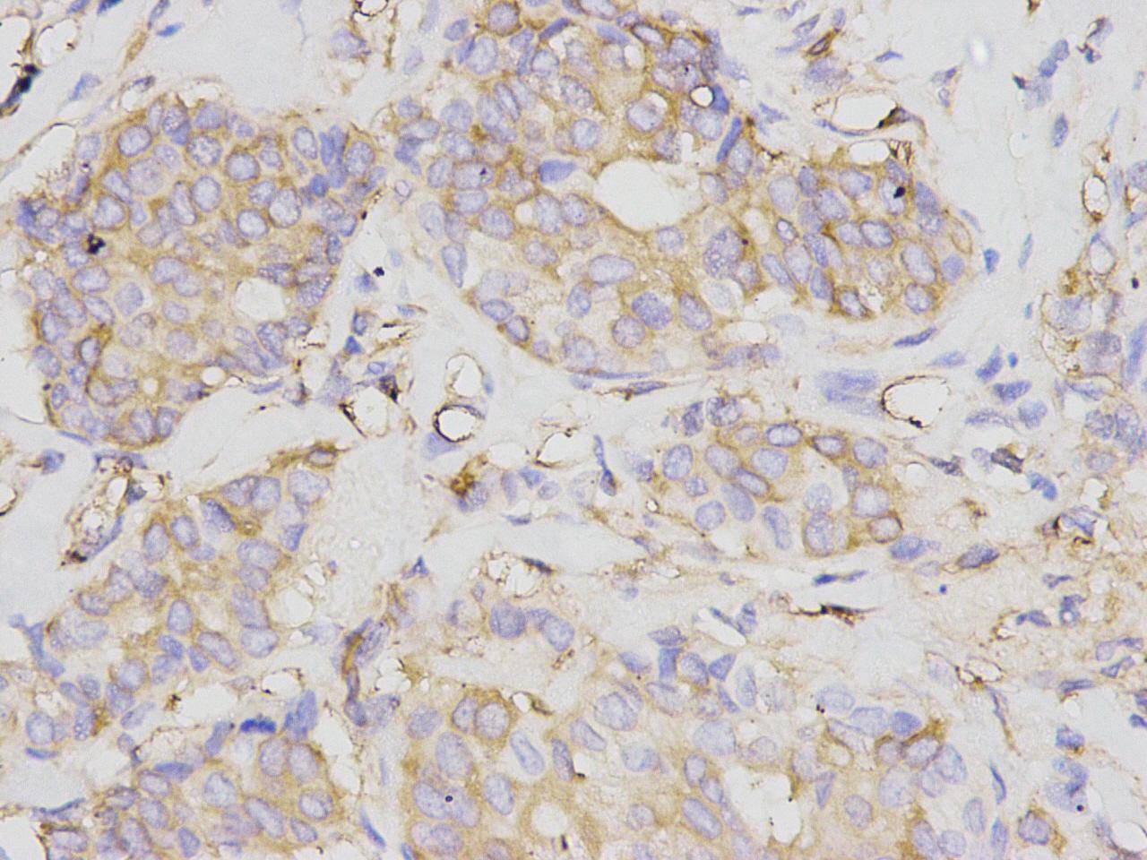 NF-κB p105/p50 Antibody