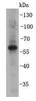 BMPR1B Antibody