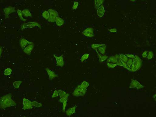 PI3-kinase p85 subunit alpha Antibody