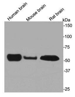 Beta III Tubulin Antibody