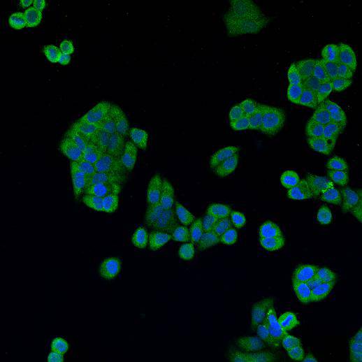 Cathepsin B Antibody