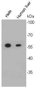 ALDH2 Antibody