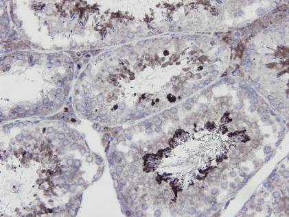 eNOS Antibody