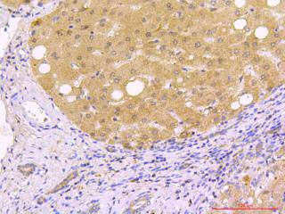 Beclin 1 Antibody