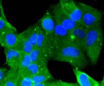 BMP11 Antibody