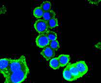 BMP11 Antibody