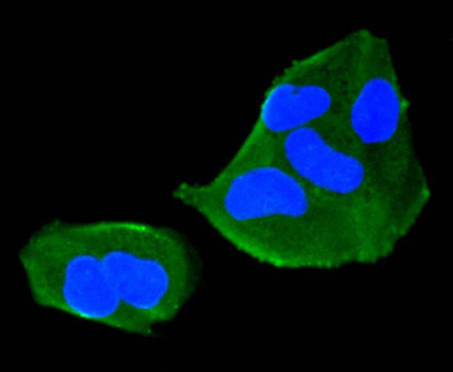 TMEM39a Antibody