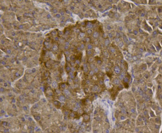 TMEM39a Antibody