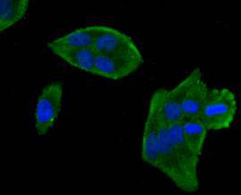 MLCK Antibody