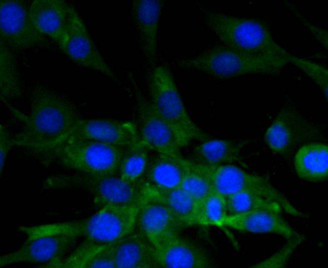 MLCK Antibody