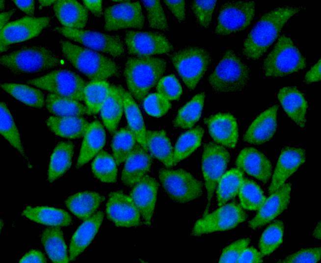 TSC2/Tuberin Antibody