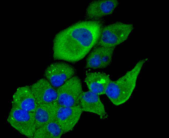 TSC2/Tuberin Antibody