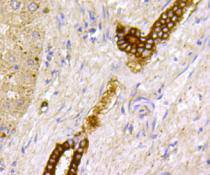 TSC2/Tuberin Antibody