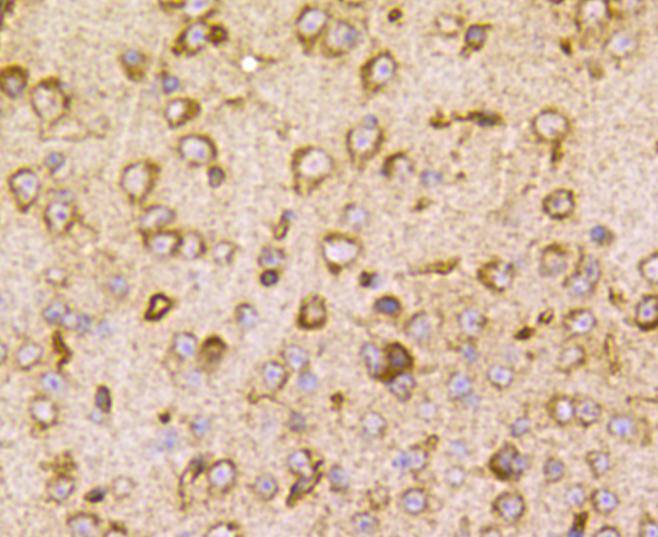 TSC2/Tuberin Antibody
