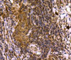 SMAD3 Antibody