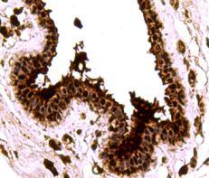 SMAD3 Antibody