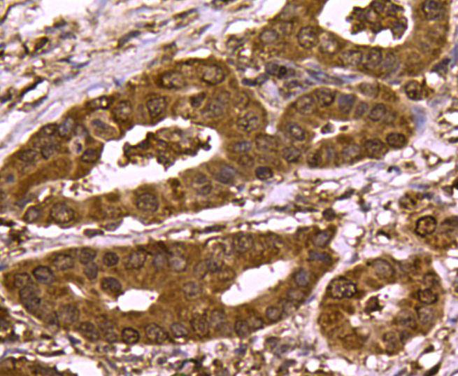 SMAD3 Antibody