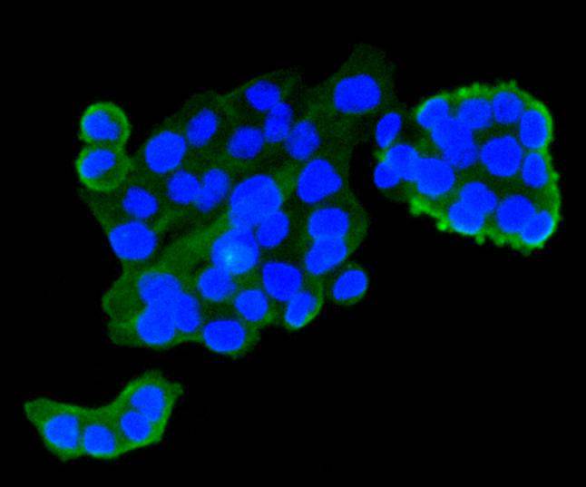IGF2R/M6PR Antibody