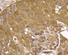 IGF2R/M6PR Antibody