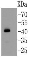 YBOX1 / YB-1 Antibody