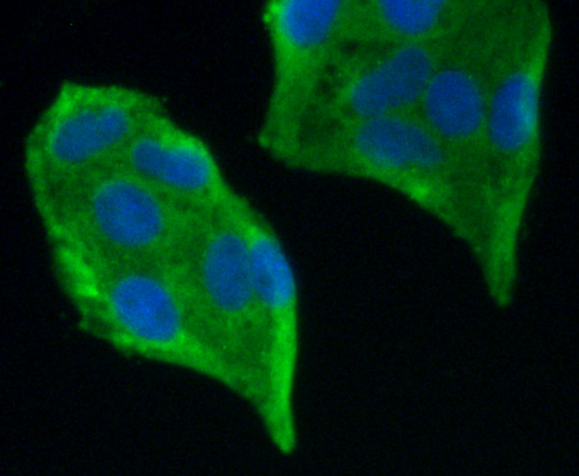 PDGF Receptor  beta Antibody