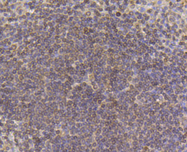PDGF Receptor  beta Antibody