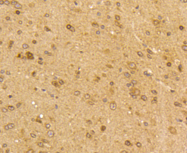 PDGF Receptor  beta Antibody