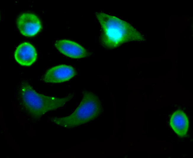 Metadherin(LYRIC) Antibody