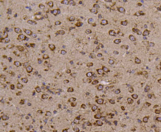 Metadherin(LYRIC) Antibody