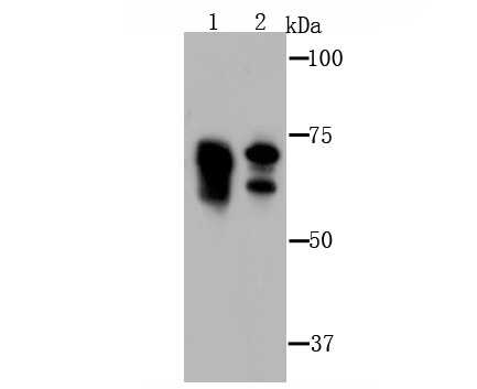 Metadherin(LYRIC) Antibody