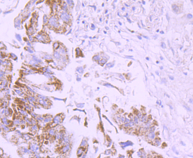 CD274(PD1L1) Antibody